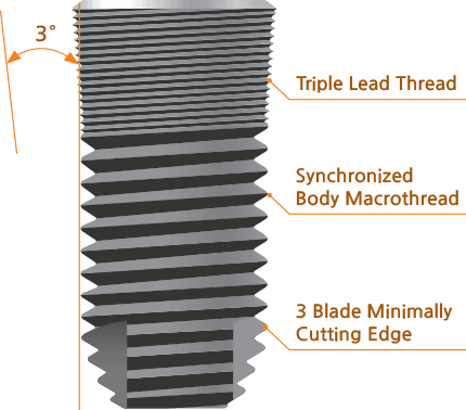 딥 임플란트 구조