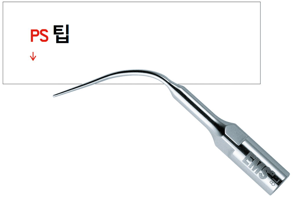 가는 스케일러 팁